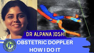 Obstetric Doppler  How I Do It  Dr Alpana Joshi  UMBILICAL ARTERY DOPPLER  MCA PI [upl. by Araiet]