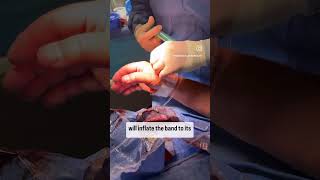 Snuff Box Closure by the Best Our team shows you TR band closure for Snuff Box Radial Access [upl. by Nnairahs]