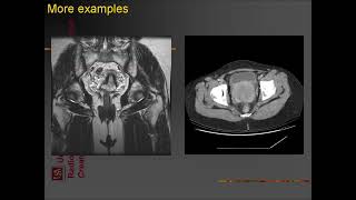 ultrasound radiologysonology [upl. by Cuthburt]