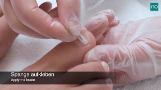 podofix® AktivKlebespange zur Nagelkorrektur [upl. by Bodnar]