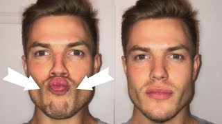 3 Exercises To Lose CHUBBY Cheeks Get a Defined Face [upl. by Seedman]