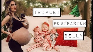 TRIPLET POSTPARTUM BELLY  CARAS POST PREGNANCY LIFE  CHATWIN SIBLING PAJAMA PARTY [upl. by Ruberta]