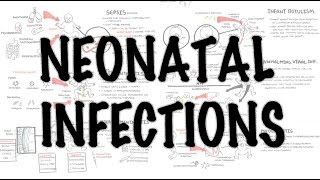 Neonatal Infections  Overview [upl. by Dahsra20]