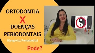 Ortodontia X Doenças Periodontais [upl. by Waldron126]