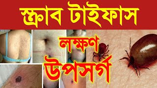 scrub typhus  scrub typhus symptoms  what is scrub typhus disease  symptoms of scrub typhus [upl. by Adien]