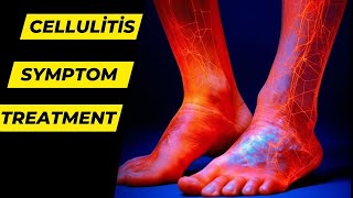 Cellulitis Causes Symptoms Treatment and Prevention  Health Go [upl. by Zita]