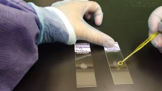 Microbiology the Catalase test [upl. by Dodge9]