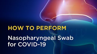 Nasopharyngeal Swab for COVID19 [upl. by Flam]