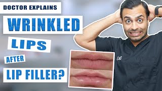 Does Lip Filler Cause Wrinkled Lips  How to Hydrate Wrinkled Lips  Dr Somji amp Dr Solomon [upl. by Ojiram]