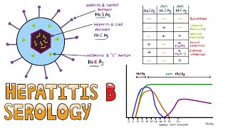 Diagnosis of Key Liver Diseases  Hepatitis A B C vs Alcoholic vs Ischemic AST vs ALT Labs [upl. by Adnirual]