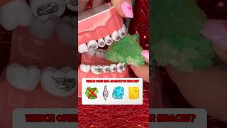 5 CRYSTAL CANDIES to AVOID with braces what to eat instead crunchy sounds shorts asmr braces [upl. by Meer632]