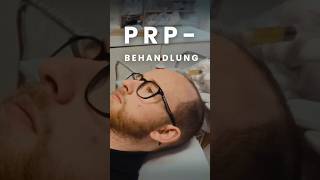 So funktioniert eine PRPBehandlung für die Haare haartransplantation [upl. by Shieh118]