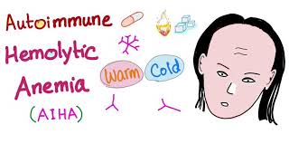 Autoimmune Hemolytic Anemia AIHA  Warm autoantibodies IgG  Hematology [upl. by Ellehsat479]