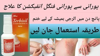 Terbisil spray uses in urdu  Terbisil Spray  fungal infection treatment  fungal infection ka ilaj [upl. by Namlas249]