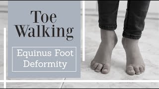 Toe walking in kids and adults  Equinus foot deformity [upl. by Uolyram601]