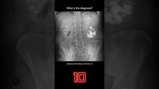 Abdominal Xray Question 9 [upl. by Sirrap269]