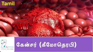 புற்றுநோய்  கீமோதெரபி   Cancer Chemotherapy  Tamil [upl. by Hannala]