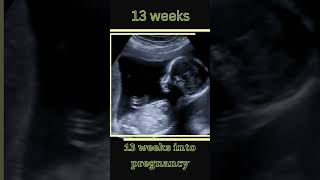 514 Weeks Embryo To Fetus Appearance On Ultrasound  ultrasound shorts [upl. by Lattonia]