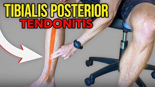 3 Exercises for Tibialis Posterior Tendonitis [upl. by Holihs]