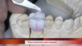 How we make a Zirconia Crown [upl. by Lerred]