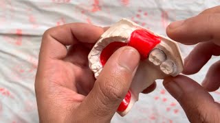 Wax Record base for partial denture  صناعة أسنان مرحلة ثالثة [upl. by Ettenwad68]