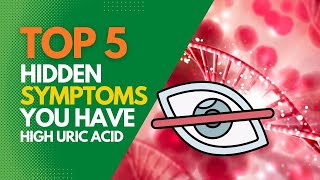 5 Hidden Symptoms You Have High Uric Acids [upl. by Nnylyaj]