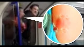 WOMAN BITES MAN S ARM IN LONDON DISGUSTING [upl. by Baiss]