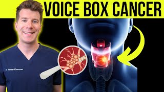 Doctor explains Laryngeal cancer voicebox cancer  Symptoms causes and treatment [upl. by Claudie669]