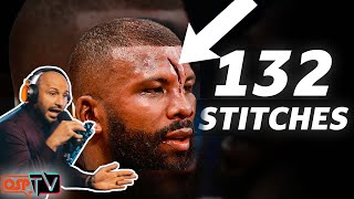 Badou Jack on his Horrific Cut  Badou Jack OSPtv CLIPS Ep13 [upl. by Acey]