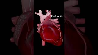 Heart anatomy heartattack heartbeat bradycardia 3danimation [upl. by Albina999]