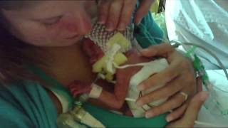 Premature Babies  One Born Every Minute [upl. by Encratia]