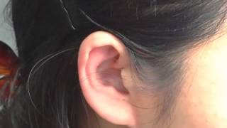 Auricular Electrical Diagnosis  Constipation  Online Acupuncture CEU [upl. by Zoie154]