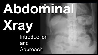 Abdominal Xray Introduction and Approach [upl. by Marvella]