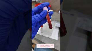 Hba1c test laboratorylife hba1c bloodsugar bloodcollection ytshorts bloodtest ytstudio rbc [upl. by Buyers873]