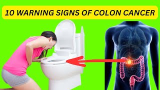 EARLY WARNING SIGNS OF COLON CANCER YOU SHOULD NOT IGNORE [upl. by Cinimmod]