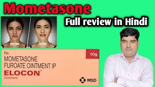 Elocon ointment full review in Hindi Composition  Side effect [upl. by Stodder]