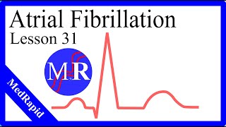 Atrial Fibrillation [upl. by Bricker]