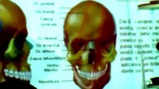 Anatomie  sistemul ososcurs [upl. by Martijn]