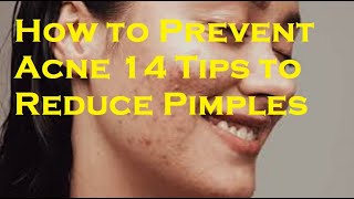 How to Prevent Acne 14 Tips to Reduce Pimples [upl. by Artina810]