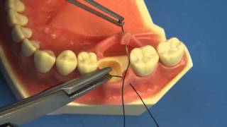 LEARN TO SUTURE THE EASY WAY  Surgical Technique  Interrupted Buccal Suturing  Dental  Medical [upl. by Gnav]