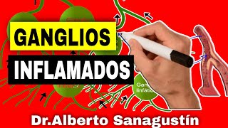 Signos PELIGROSOS en GANGLIOS LINFÁTICOS INFLAMADOS Adenopatías [upl. by Lenora]