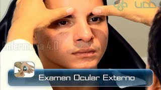 🌟EXAMEN OCULAR EXTERNO🌟 [upl. by Necyrb]