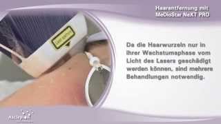 Haarentfernung mit dem Diodenlaser MeDioStar NeXT PRO von Asclepion [upl. by Woodson]