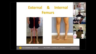 Fix your knee pain by fixing your posture [upl. by Niassuh825]