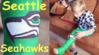 🏈Kid gets a SEATTLE SEAHAWKS Cast for Broken Leg🏈 [upl. by Kcirddet]