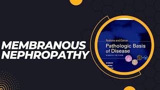 Membranous nephropathy  Pathogenesis  Morphology  Clinical features [upl. by Yentyrb486]