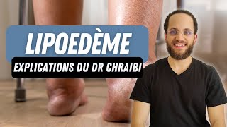 Jambes poteaux lipoedème  Un Dr explique tout de A à Z [upl. by Gilud]