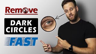 BEST ways to get rid of DARK CIRCLES under your EYES  THE TRUTH [upl. by Etak]