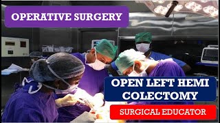 OPEN LEFT HEMICOLECTOMY STEP BY STEP Operative Surgery [upl. by Ayekat]