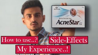 Acnestar Soap  Acne transformation with Acnestar soap Benzoyl peroxide 25 [upl. by Guimar]